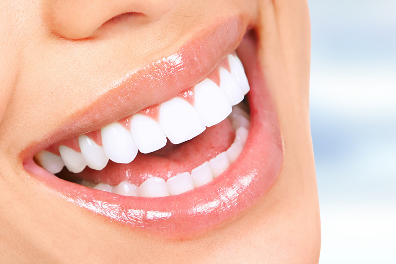 Cosmetic Dentistry in Sunnyvale